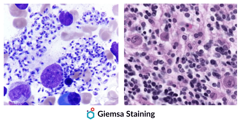 Giemsa Staining