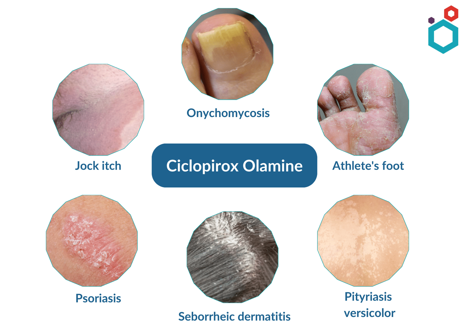 Uses of Ciclopirox olamine